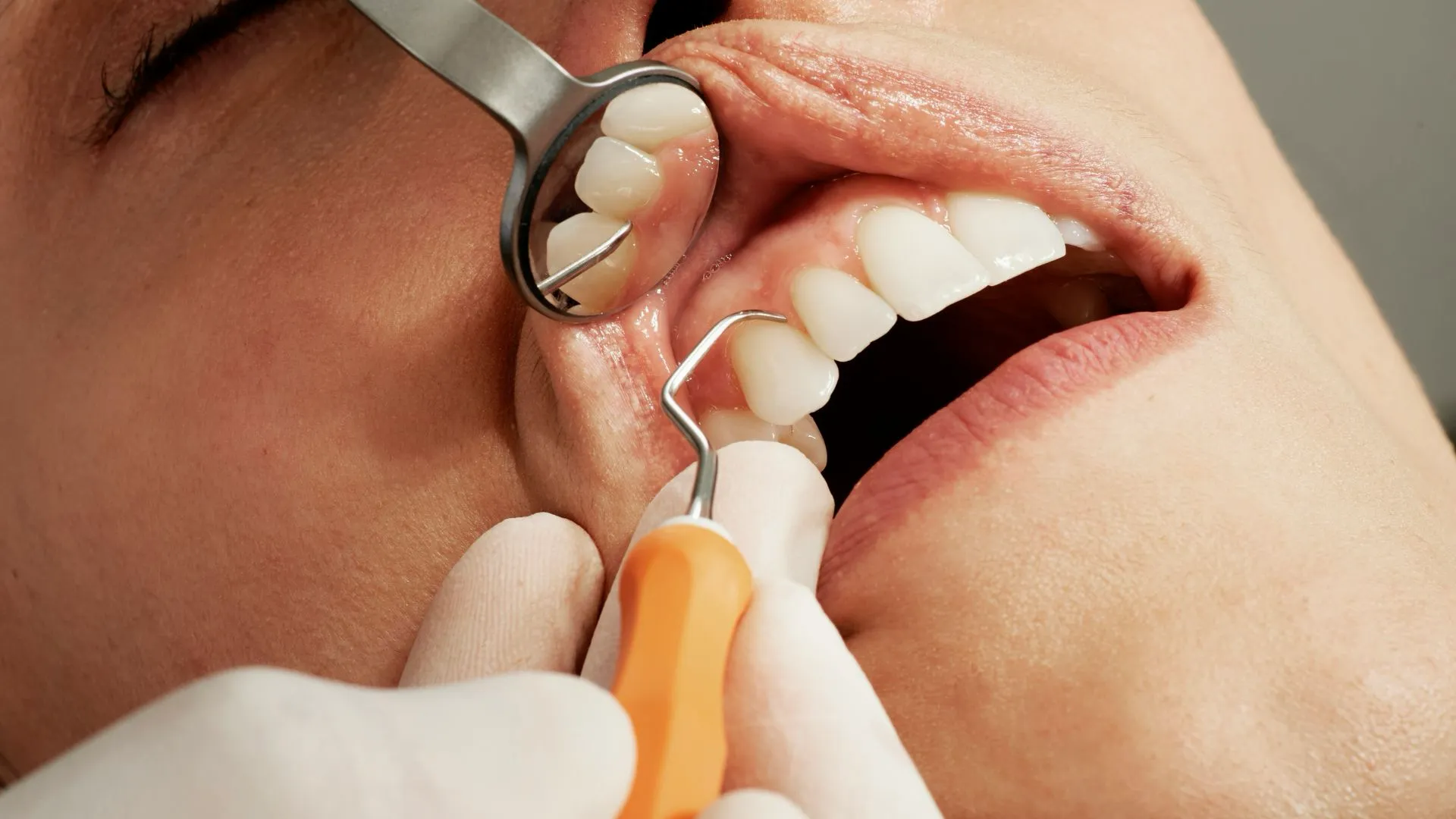 inspection de la bouche d'un patient